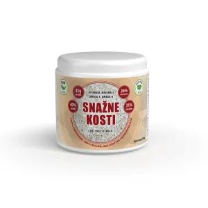 Snazne-kosti